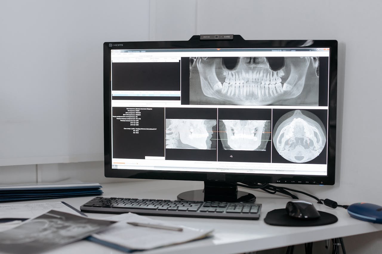 Monitor displaying dental X-ray images in a clinic setup for diagnostic purposes.